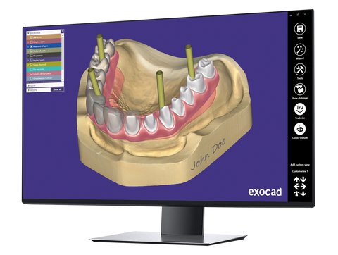 CAD Design Software exocad Implant