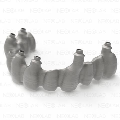 Implant Bridge/Bar Big (>6 Teeth) CoCr SLM 3D Print