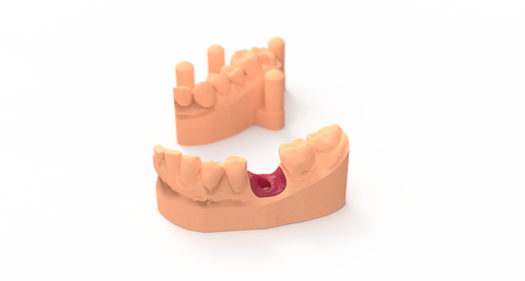 Working Model Jaw mSLA 3D Print